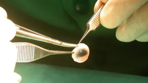 WhatsApp Image 2026-01-06 at 09.51.44