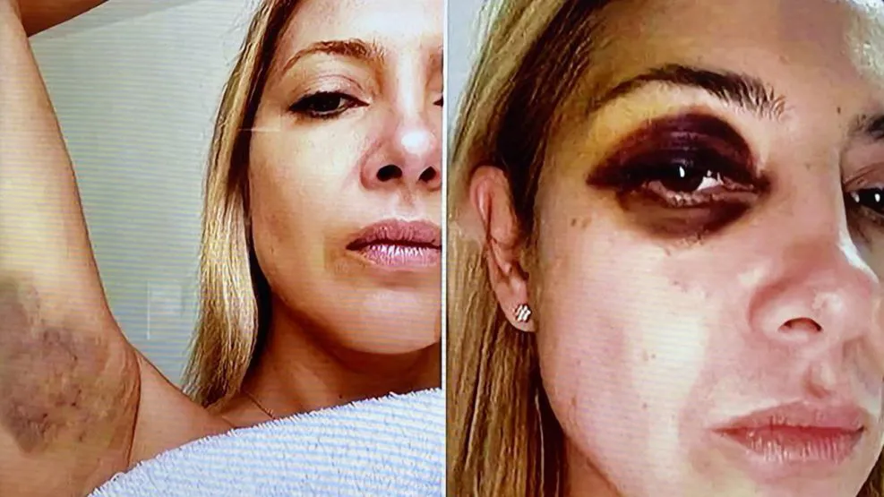 los-golpes-a-fabiola-yanez-1851380