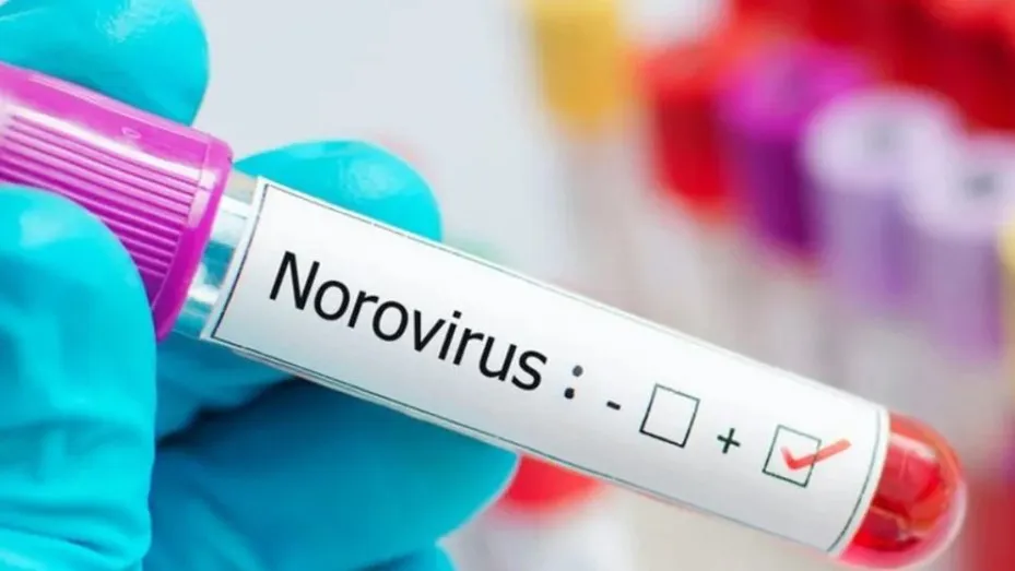 norovirus