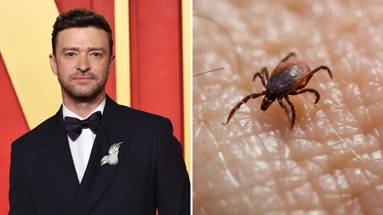 justin-timberlake-enfermedad-lyme-que-es281%29